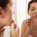 Understanding Gut Health and Its Impact on Cystic Acne