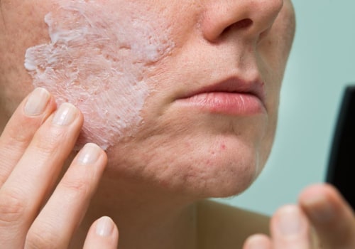 Understanding Benzoyl Peroxide for Cystic Acne