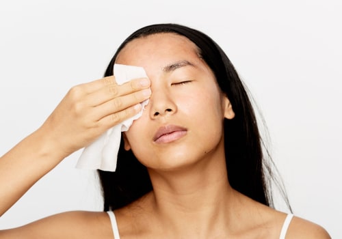 Cleansing Wipes for Cystic Acne: What You Need to Know